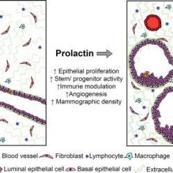 The root in the term prolactinoma means